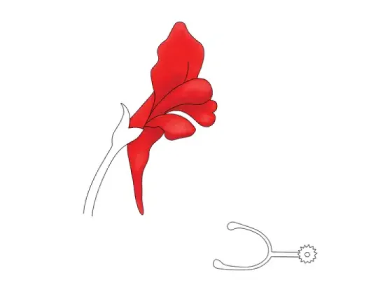 Image of Types of Gamopetalous Corollas